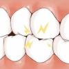 5种停止磨牙的方法