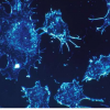 在癌细胞中生产金纳米颗粒的新方法