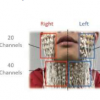 研究人员提出了用于自动语音识别的高密度表面肌电图技术