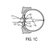 Google专利申请书提出了解决视力不佳的设备