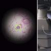 谷歌AR显微镜使用机器学习快速发现癌细胞