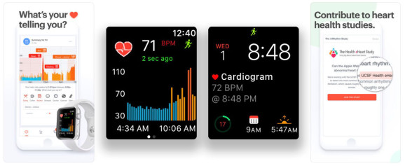 Apple Watch心电图应用程序击败EKG乐队发现错误的心跳