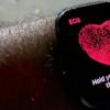 苹果与强生公司共同研究Apple Watch应用程序是否可降低中风风险