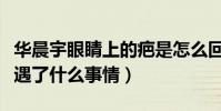 华晨宇眼睛上的疤是怎么回事(起底华晨宇遭遇了什么事情)