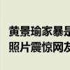 黄景瑜家暴是怎么回事（网上流出黄景瑜家暴照片震惊网友）