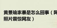 黄景瑜家暴是怎么回事(网上流出黄景瑜家暴照片震惊网友)
