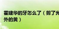 霍建华的牙怎么了(剪了光头的他牙齿显得格外的黄)