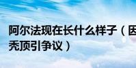 阿尔法现在长什么样子(因为熬夜而导致年少秃顶引争议)