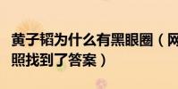 黄子韬为什么有黑眼圈(网友扒出黄子韬童年照找到了答案)