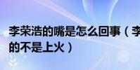 李荣浩的嘴是怎么回事(李荣浩自曝车祸造成的不是上火)