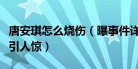 唐安琪怎么烧伤(曝事件详情及其被烧伤照片引人惊)
