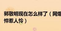郭敬明现在怎么样了(网爆郭敬明近照状态憔悴惹人怜)