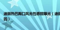 迪丽热巴胸口风光性感照曝光(迪丽热巴胸为什么不捂了原因)