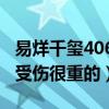 易烊千玺406事件是什么意思（网曝易烊千玺受伤很重的）
