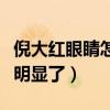 倪大红眼睛怎么回事（近几年的眼袋是越来越明显了）