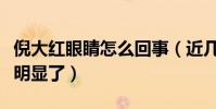 倪大红眼睛怎么回事(近几年的眼袋是越来越明显了)