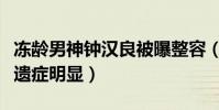 冻龄男神钟汉良被曝整容(上新综艺脸部医美遗症明显)