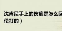 沈肯尼手上的伤疤是怎么回事(网传是被沈煜伦打的)
