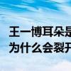 王一博耳朵是什么时候受的伤（王一博的耳垂为什么会裂开）
