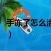 手冻了怎么治疗以后不再犯了（手冻了怎么治）