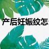 产后妊娠纹怎么除掉（产后妊辰纹能去掉吗）