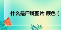 什么是尸斑图片 颜色(什么是尸斑)