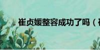 崔贞媛整容成功了吗(崔贞媛整容)