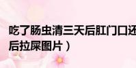 吃了肠虫清三天后肛门口还有虫(吃了肠虫清后拉屎图片)
