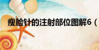 瘦脸针的注射部位图解6(瘦脸针的注射)