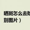 晒斑怎么去除最有效的方法（晒斑和黄褐斑区别图片）