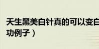 天生黑美白针真的可以变白吗(天生黑美白成功例子)