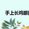 手上长鸡眼图片 原因（手上长鸡眼图片）
