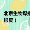 北京生物焊接双眼皮多少钱（北京生物焊接双眼皮）
