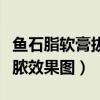 鱼石脂软膏拔脓效果图片大全（鱼石脂软膏拔脓效果图）