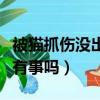 被猫抓伤没出血有事吗图片（被猫抓伤没出血有事吗）